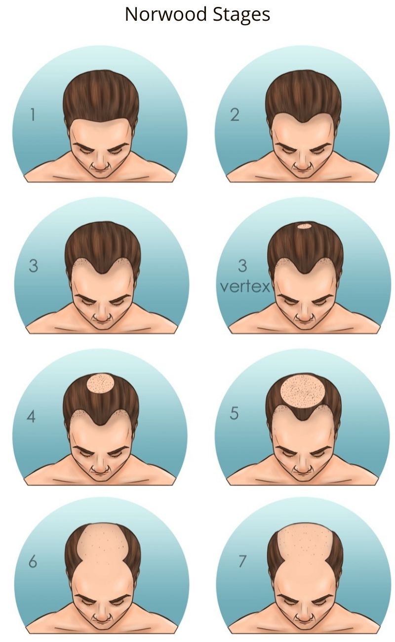 Men's Hairstyles Today on X: 