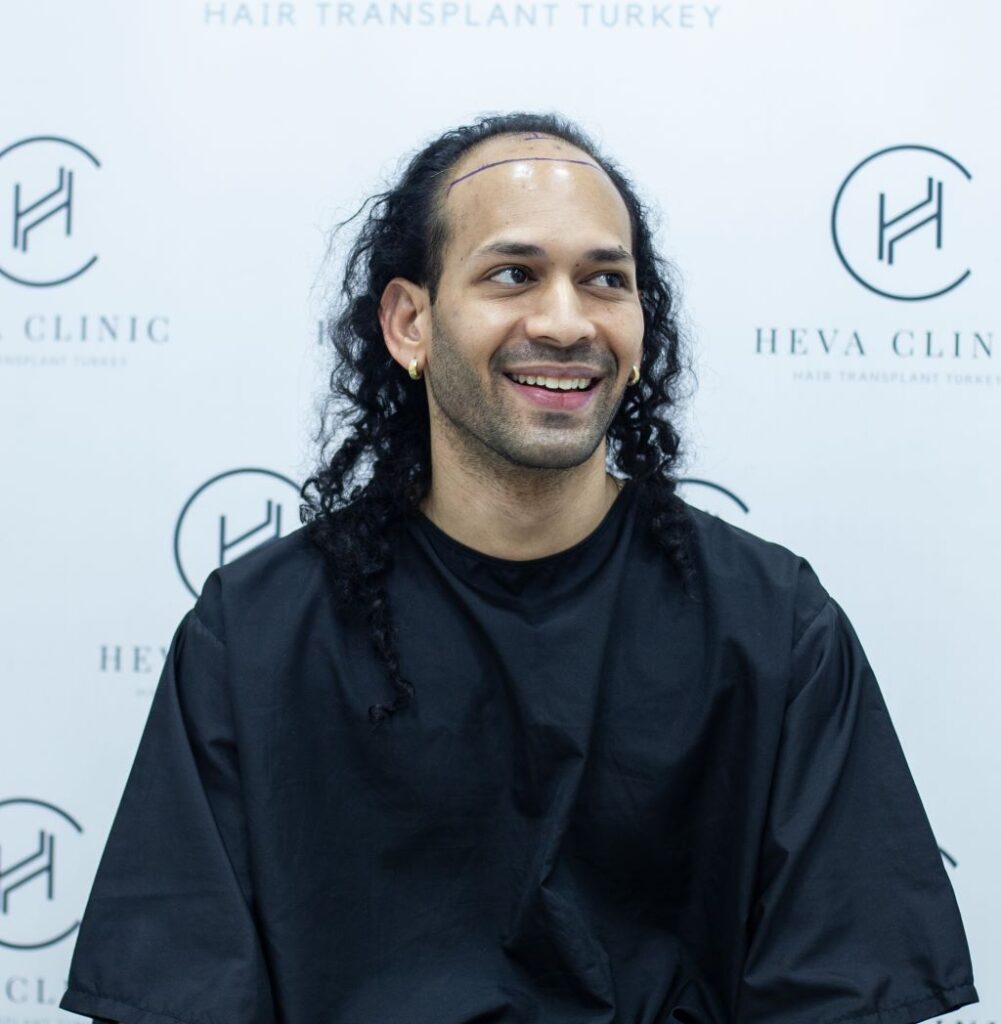Hair Transplant for Receding Hairline - Heva Clinic Hair Transplant for Receding Hairline - Heva Clinic