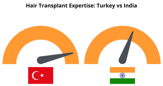 Hair Transplant Expertise Turkey vs India