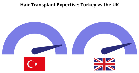 Hair Transplant Expertise in Turkey vs the UK