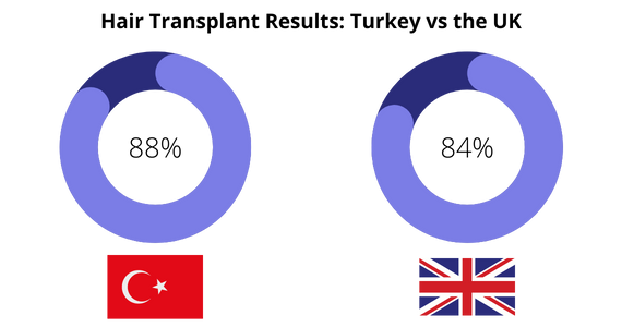 Hair Transplant Results in Turkey vs the UK Hair Transplant Results in Turkey vs the UK