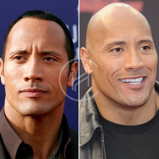 Shaved head before and after The Rock