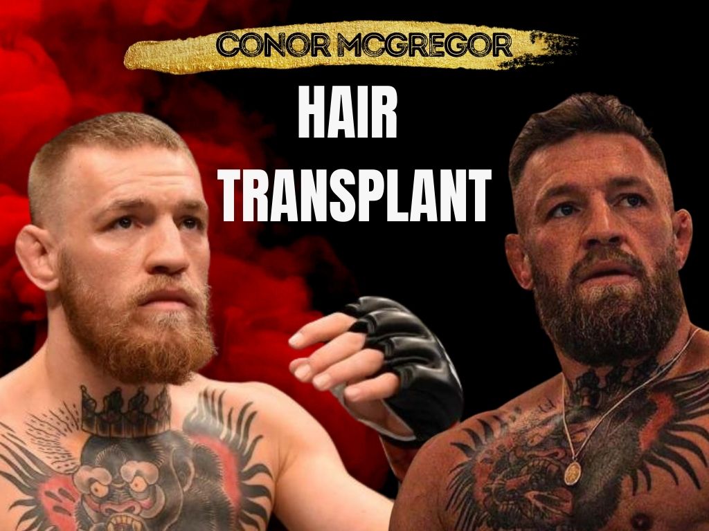 Conor McGregor's Hair Evolution: From Buzz Cut to Man Bun - wide 1