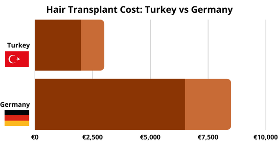 Hair Transplant Costs in Turkey vs Germany