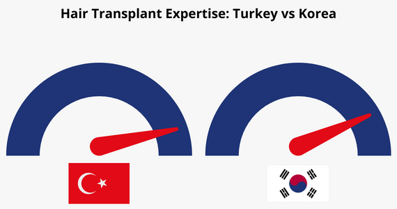 Hair Transplant Expertise in Turkey vs Korea