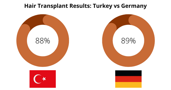 Hair Transplant Results in Turkey vs Germany