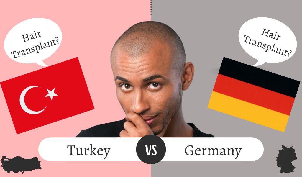 Hair Transplant Turkey vs Germany