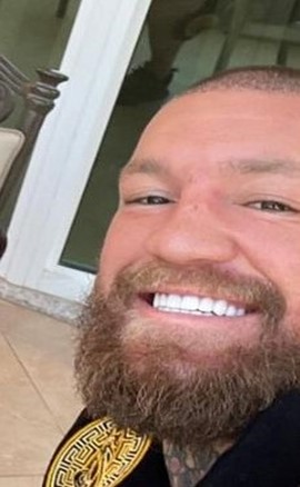 Hair transplant scabs Conor McGregor