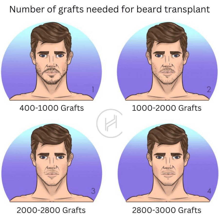 Number of grafts needed for beard transplant