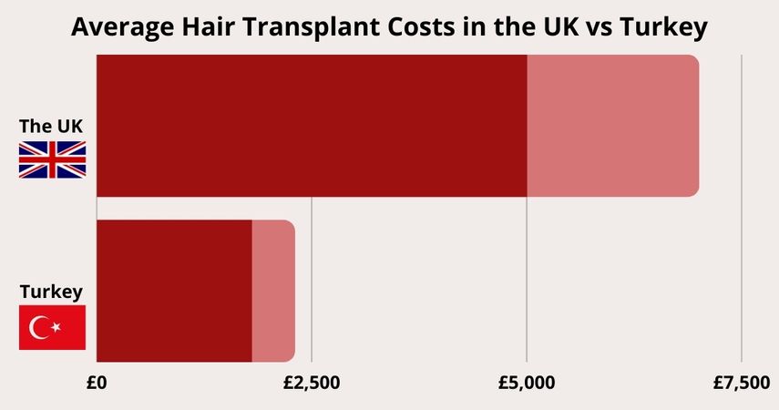Average Hair Transplant Costs in the UK vs Turkey