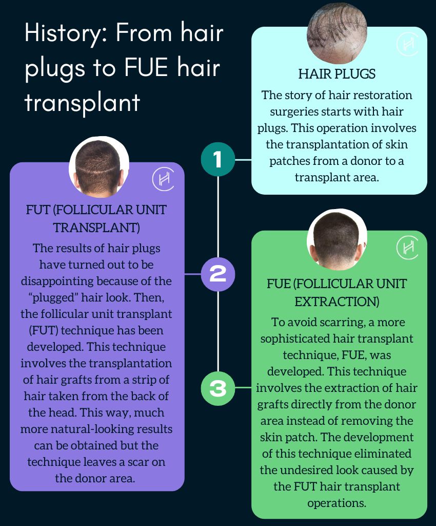 History of hair plugs - From hair plugs to FUE hair transplant
