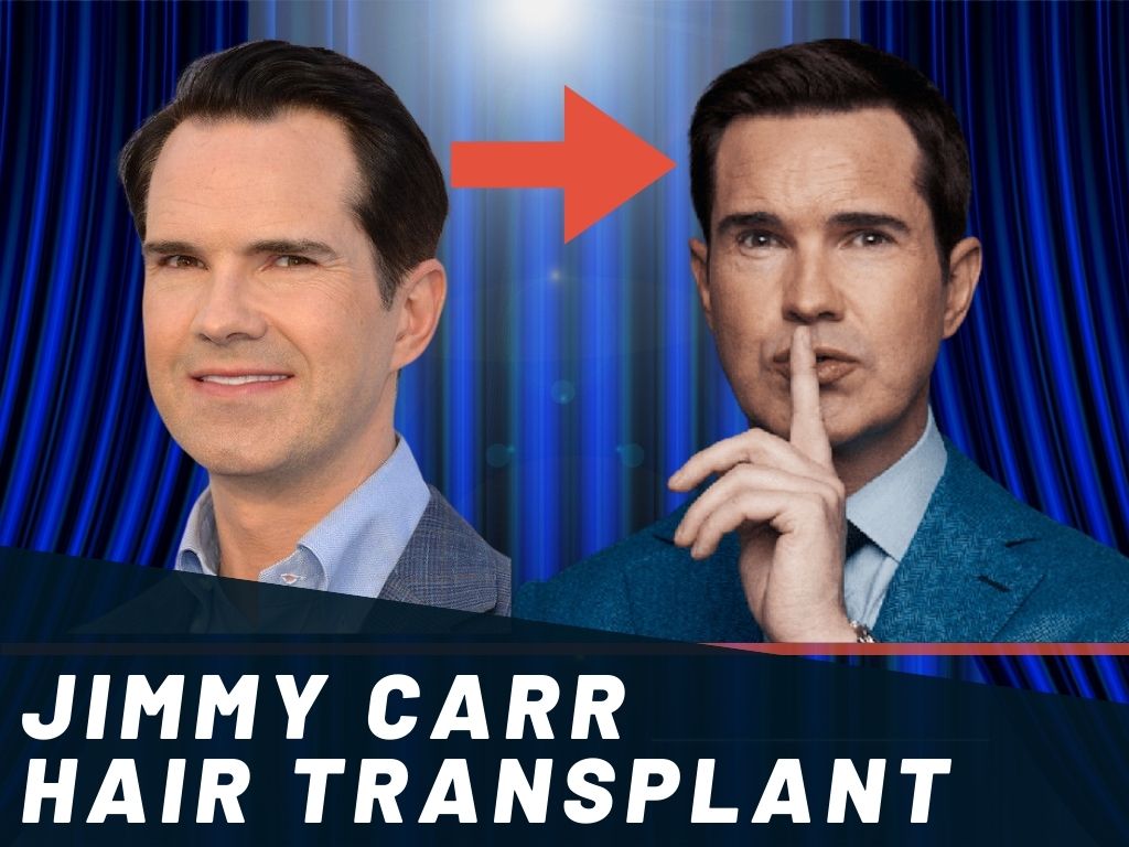 Jimmy Carr Hair Transplant Banner