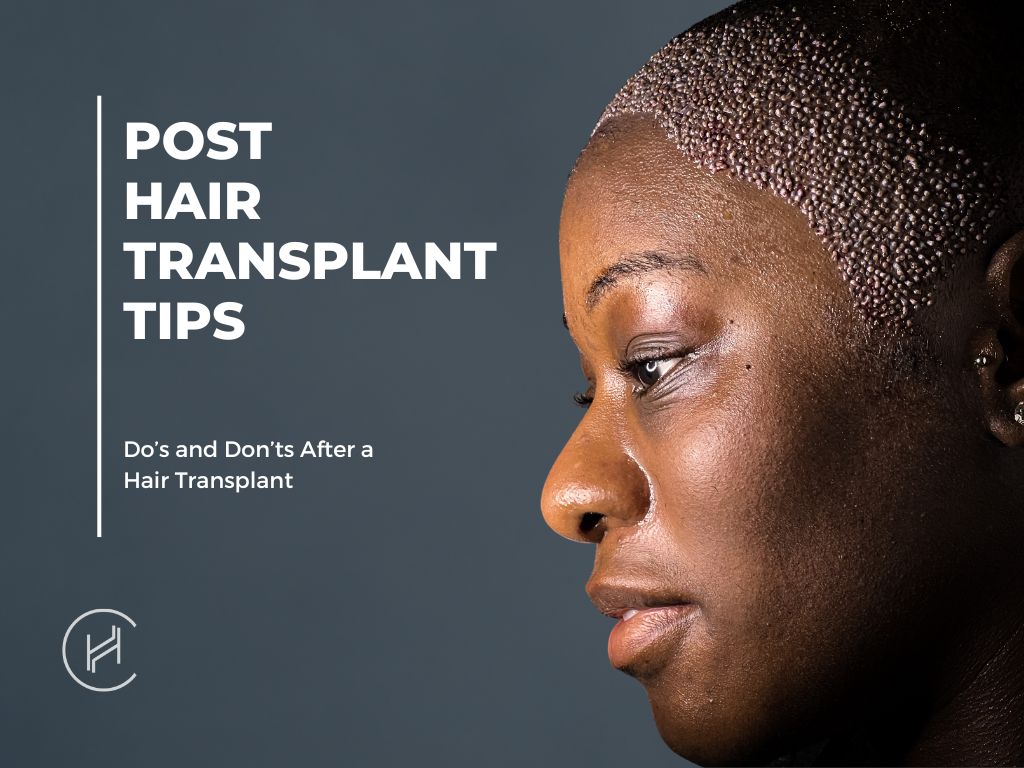 Post-Hair Transplant Tips Afro Female Banner