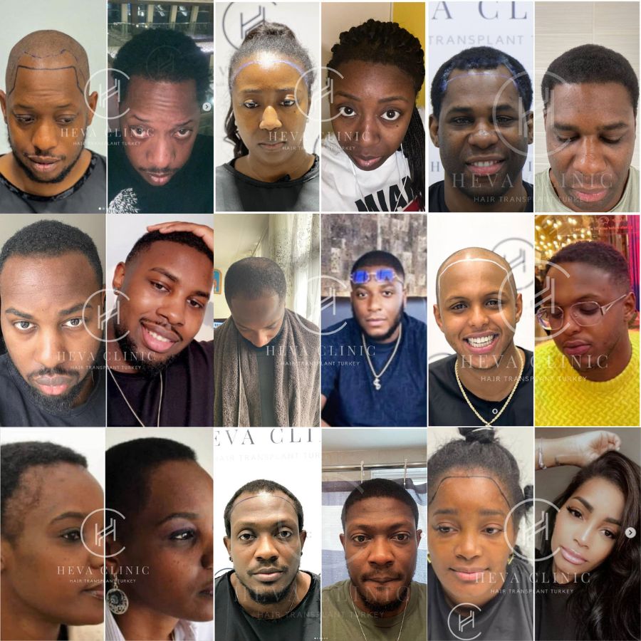 20 Coolest Fade Haircuts for Black Men in 2023