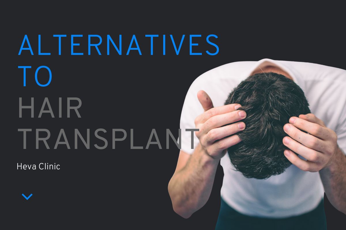 Alternatives to Hair Transplant