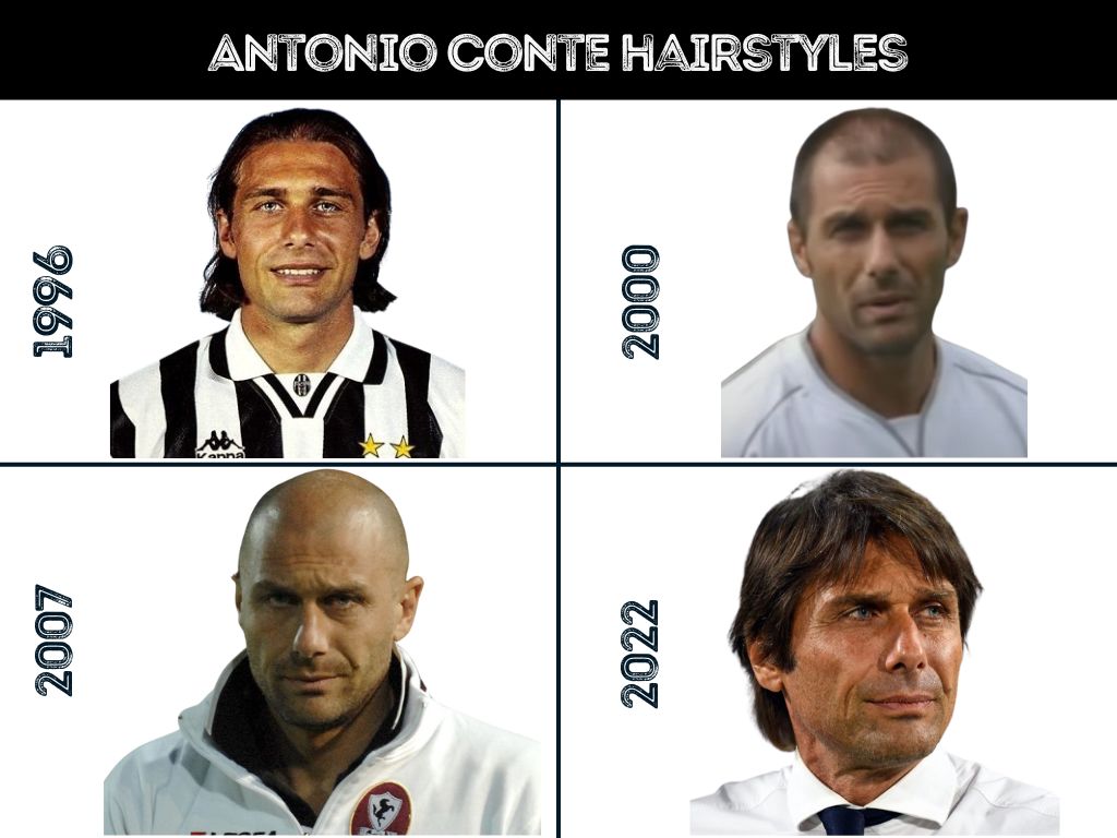 Antonio Conte hairstyles and hair loss throughout the years