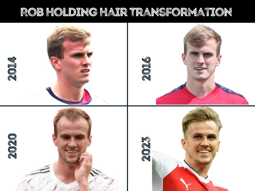 Rob Holding Hair Transformation