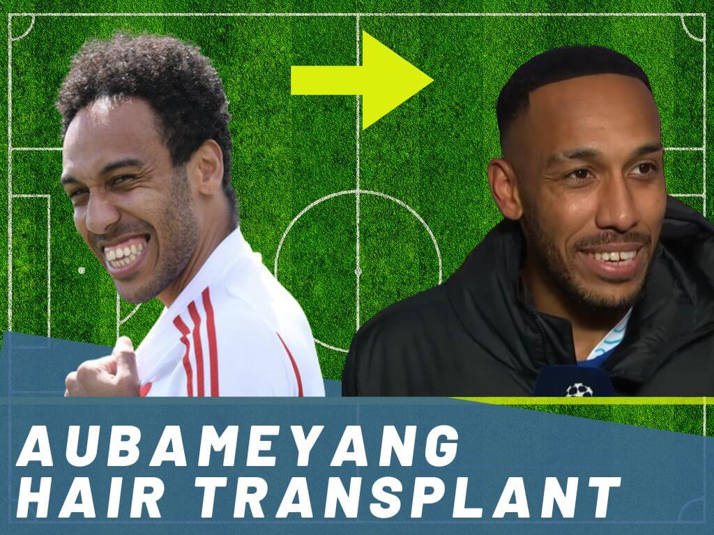 Aubameyang Hair Transplant Analysis Content Banner