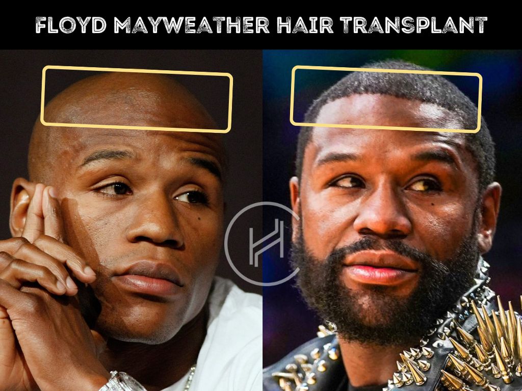 Before and after Floyd Mayweather frontline change