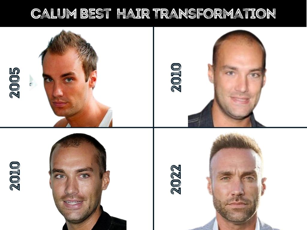Calum Best Hair Transformation