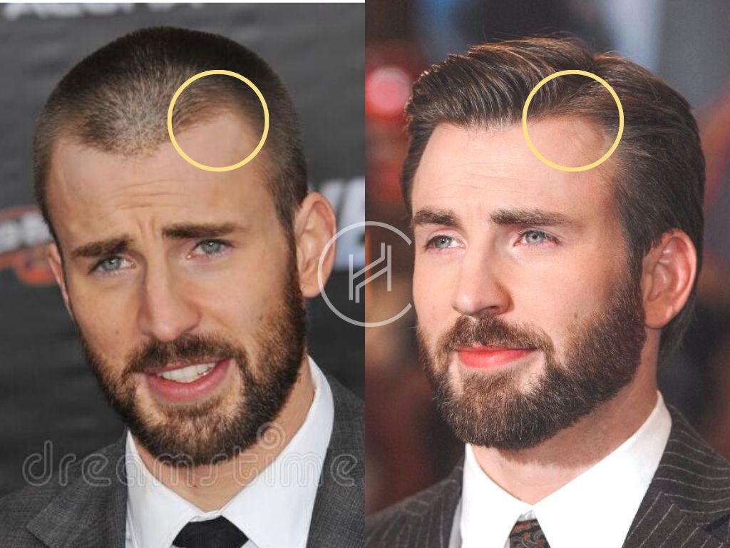 Chris Evans Haircut  Hairbond 