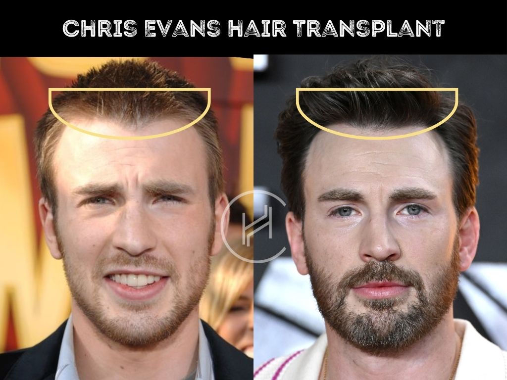 Captain America Haircut How To Get Chris Evans Hairstyle