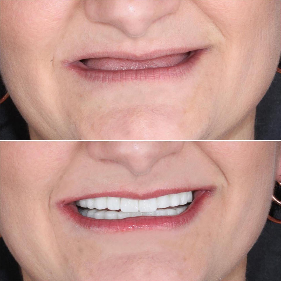 dental treatment before and after