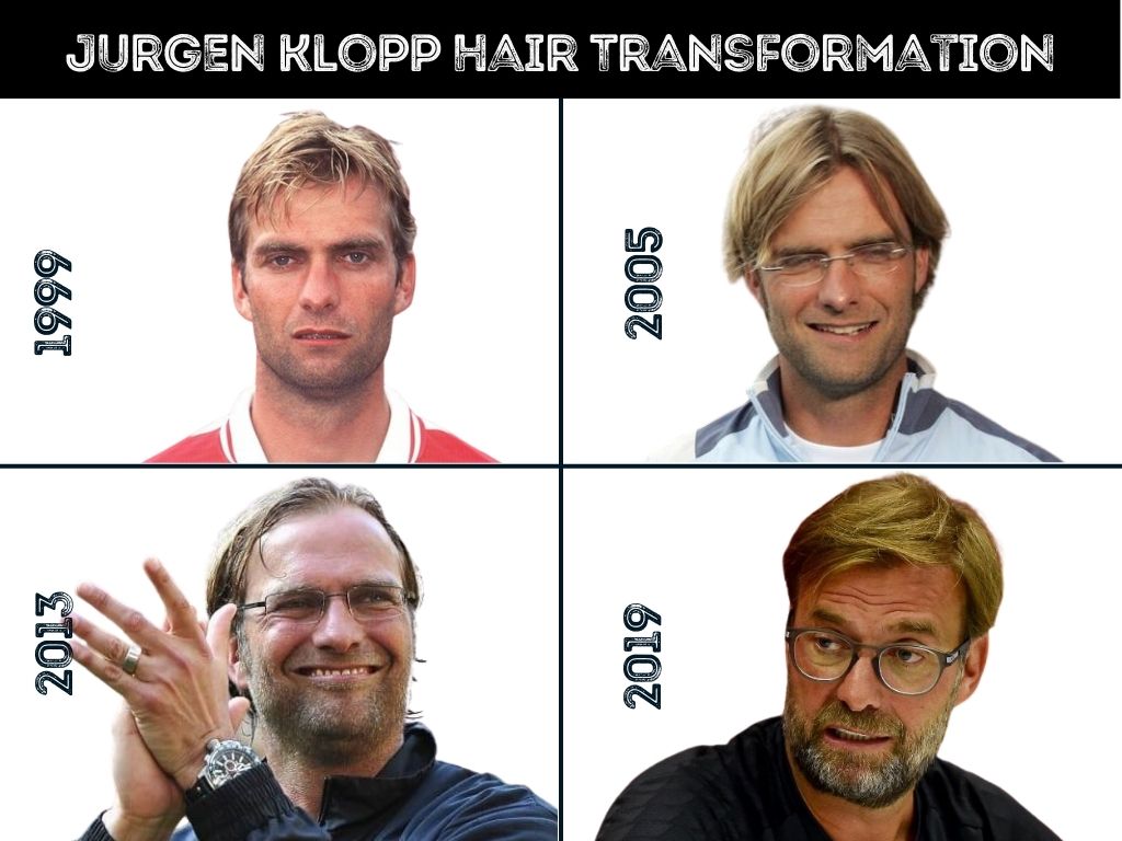 Jurgen Klopp Hair Transformatıon