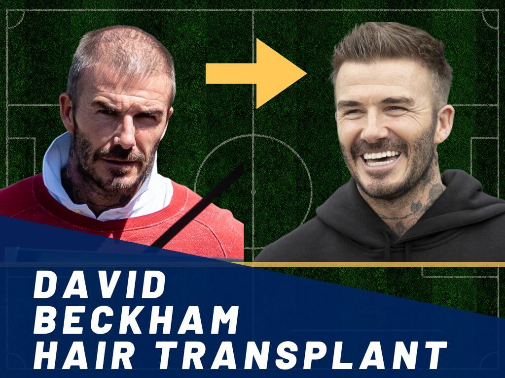 20 Hottest David Beckham Hairstyles to Inspire Your Next Look | PINKVILLA