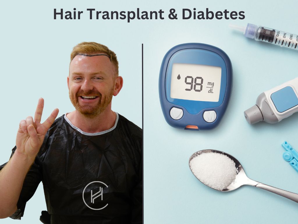 Hair Transplant and Diabetes banner
