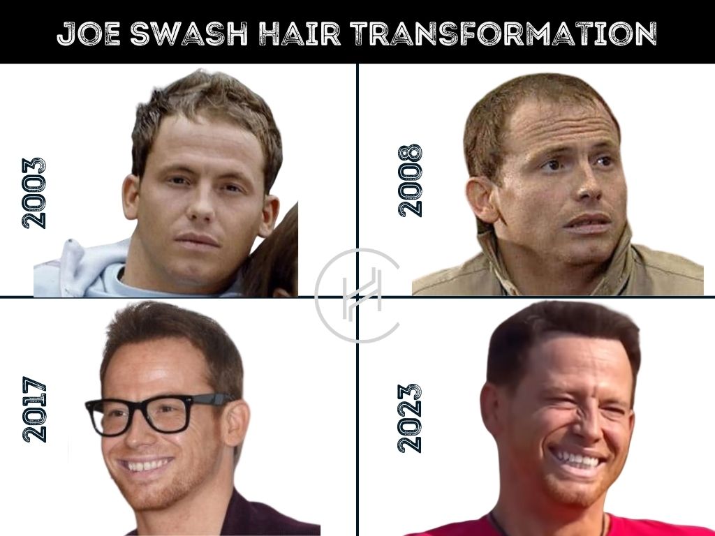 Joe Swash Hair Transformation