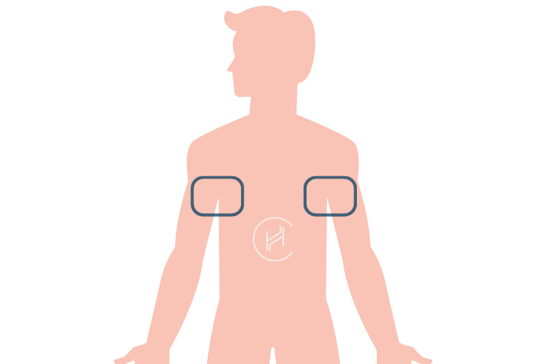 Armpit hair for hair transplant - area