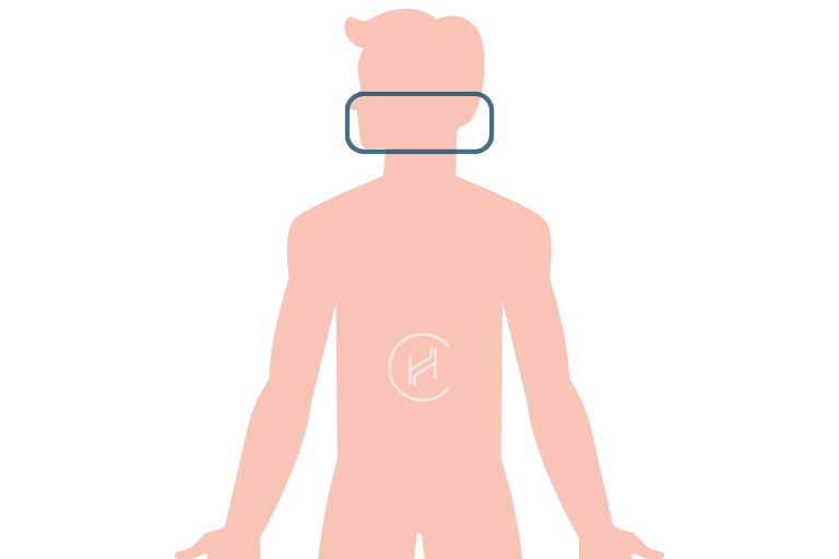 Beard for hair transplant - area