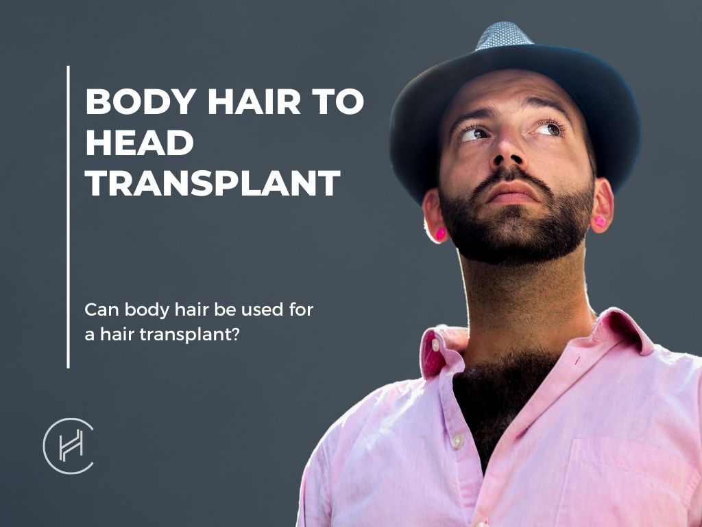 Body hair to head transplant banner
