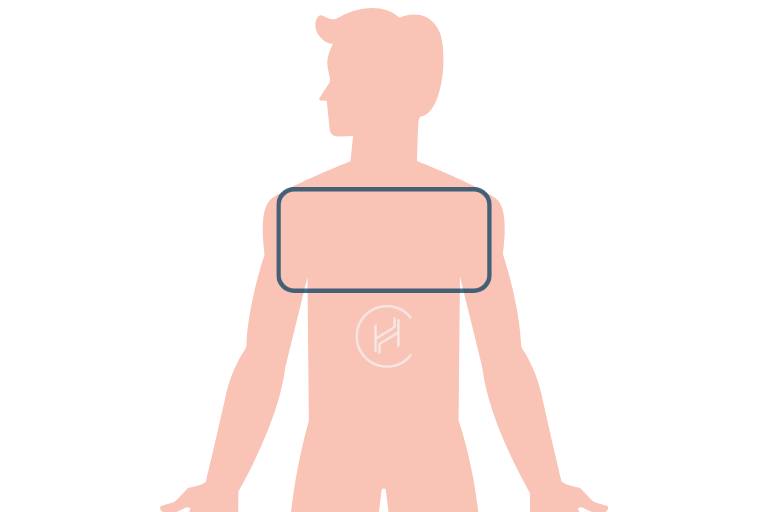 Chest hair for hair transplant - area