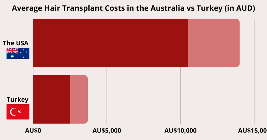 Average Hair Transplant Costs in the Australia vs Turkey (in AUD) chart