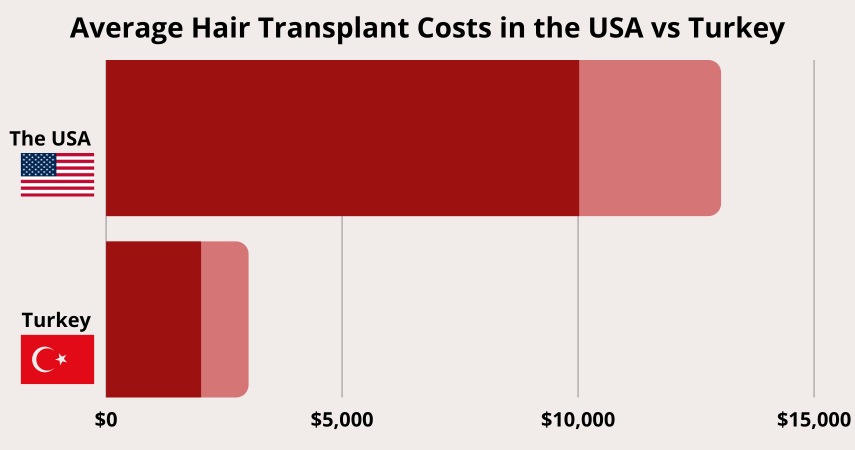 Average Hair Transplant Costs in the USA vs Turkey