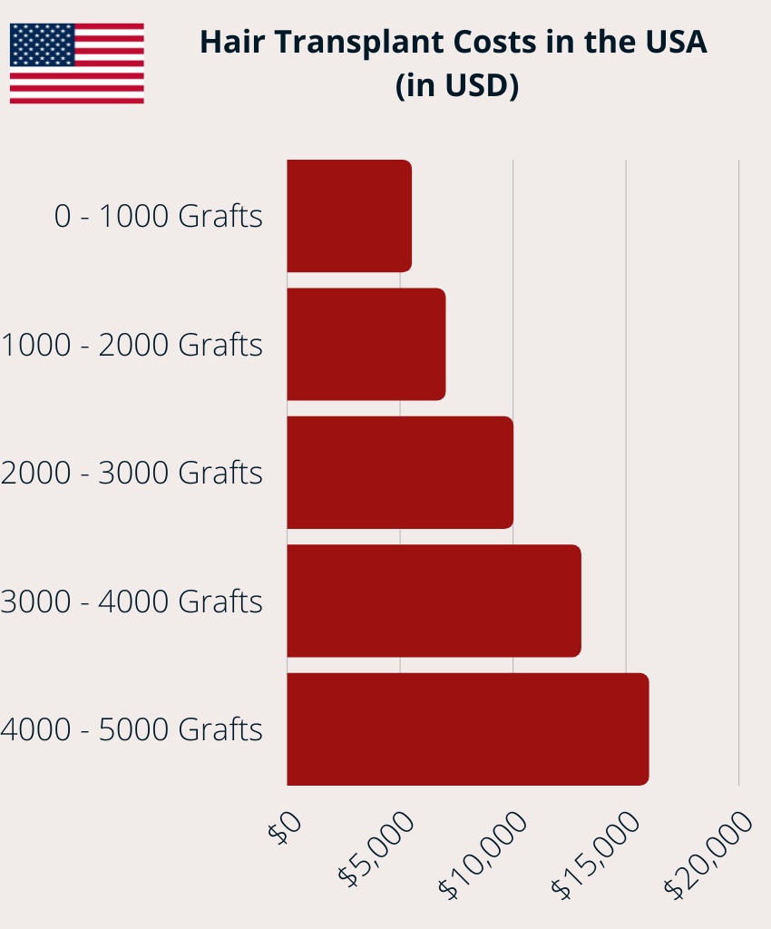 Hair Transplant Costs in the USA (in USD) Chart