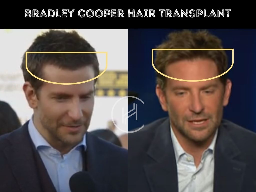 Bradley Cooper Doesn't Like the Oscars - Is It Because He's Never Won?