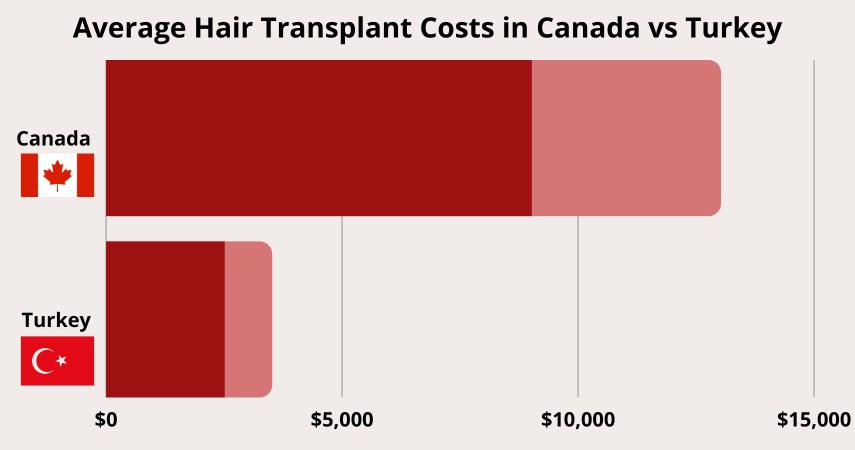 Average Hair Transplant Costs in Canada vs Turkey - Chart
