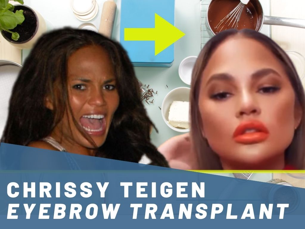 Chrissy Teigen Eyebrow Transplant Banner