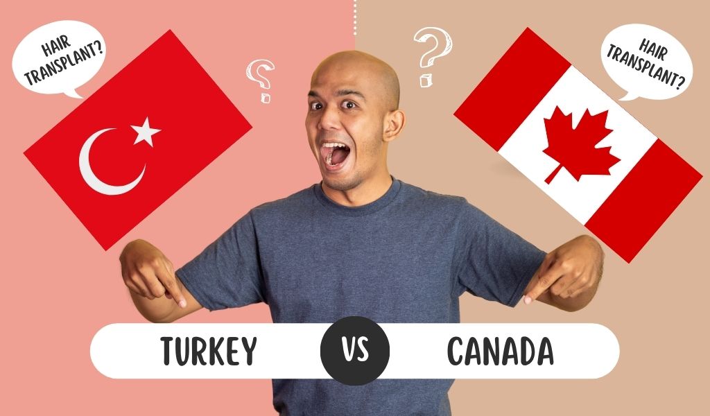 Hair Transplant Canada vs Turkey - Overview Banner