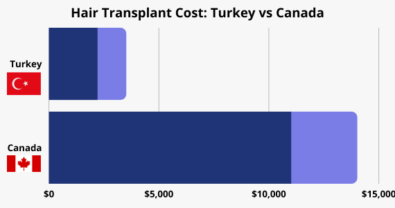 Hair Transplant Cost Turkey vs Canada