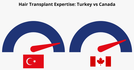 Hair Transplant Expertise Turkey vs Canada