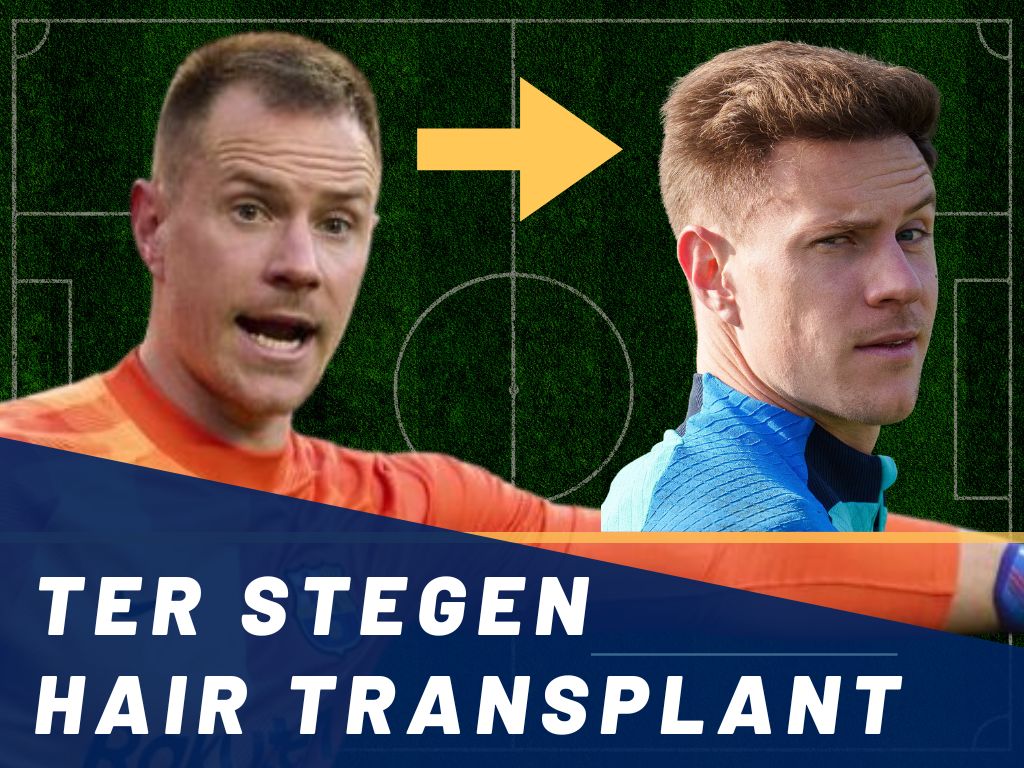 Ter Stegen Hair Transplant Analysis Banner