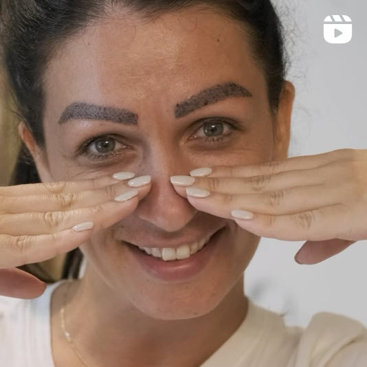 eyebrow transplant in turkey journey at heva clinic istanbul
