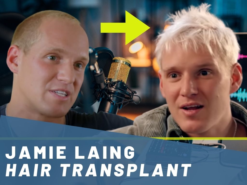 jamie laing hair transplant analysis banner
