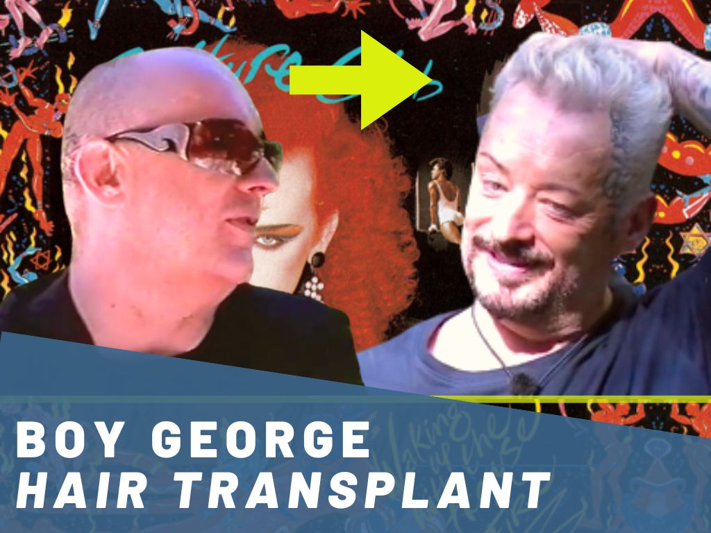 boy george hair transplant analysis banner