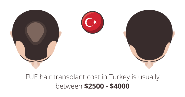 FUE hair transplant cost Turkey