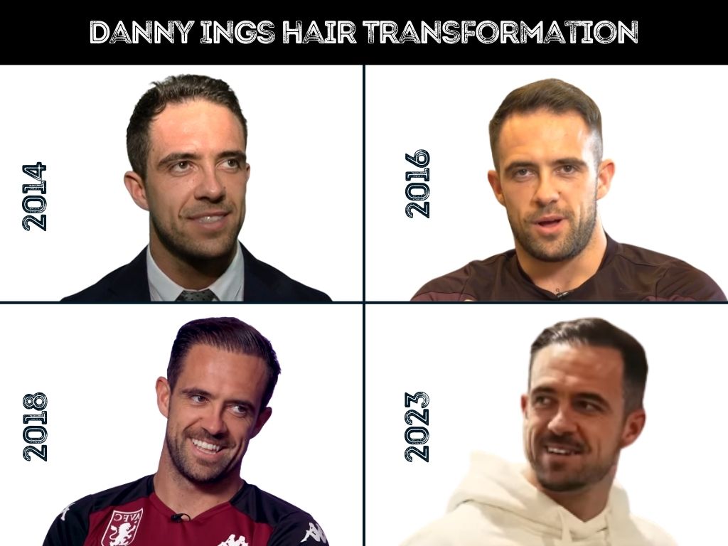 danny ings hair transformation